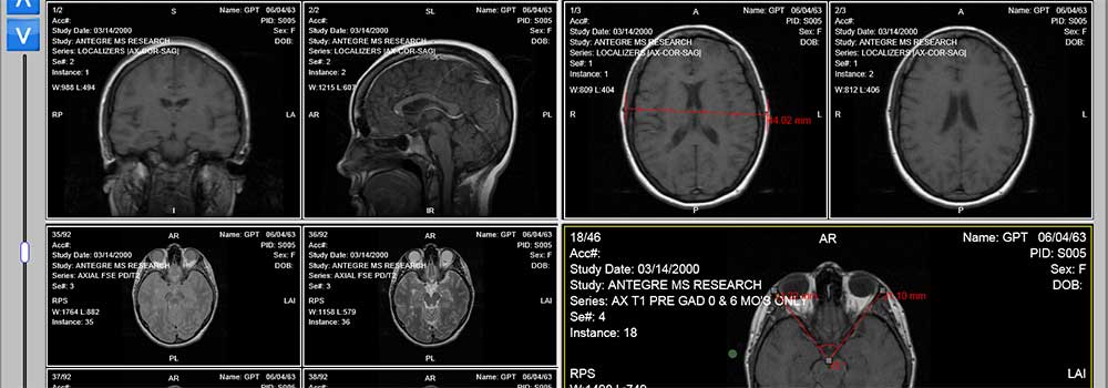 DICOM-viewer-on-NextReading