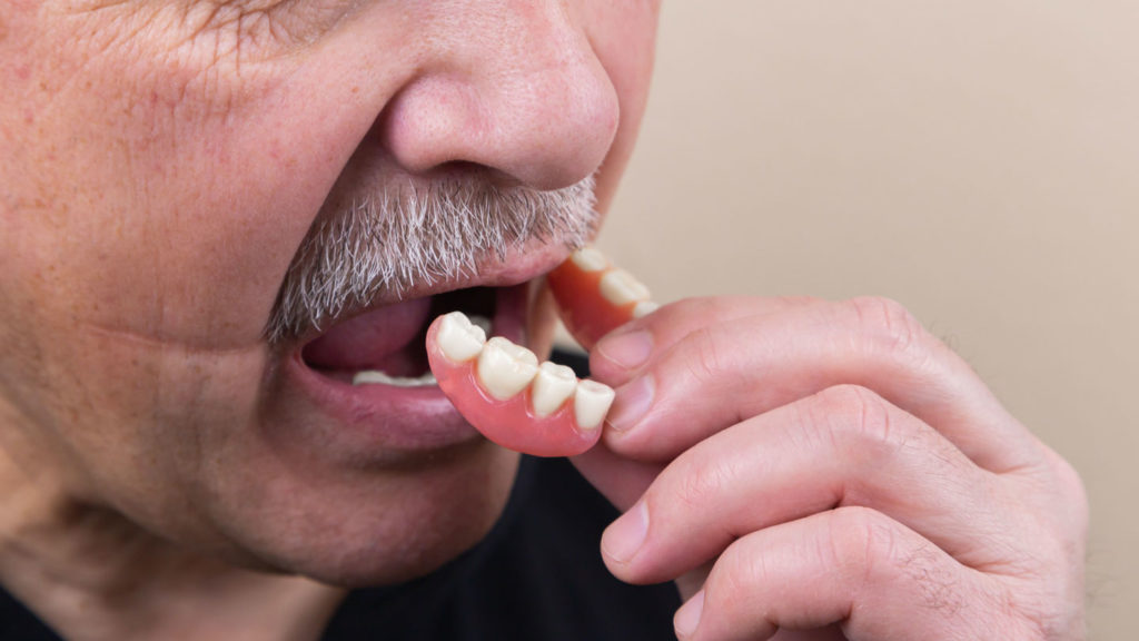Some-Method-to-Straighten-Your-Teeth-without-Brace-on-nextreading-online