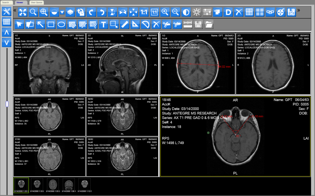 DICOM viewer web