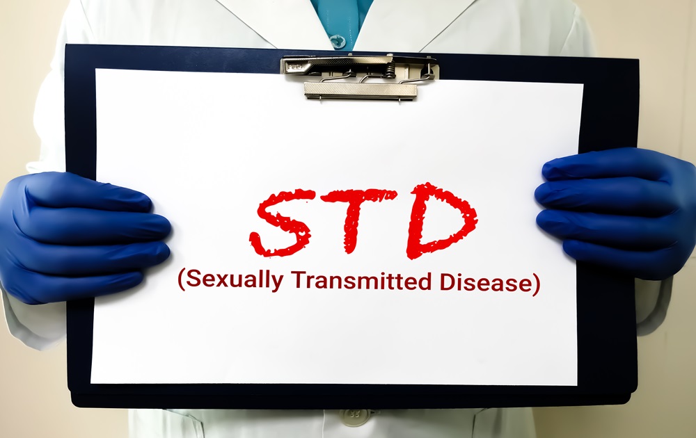 std testing in los angeles